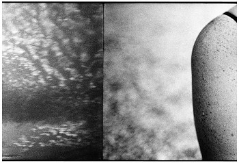 Work: Magda's Shoulder